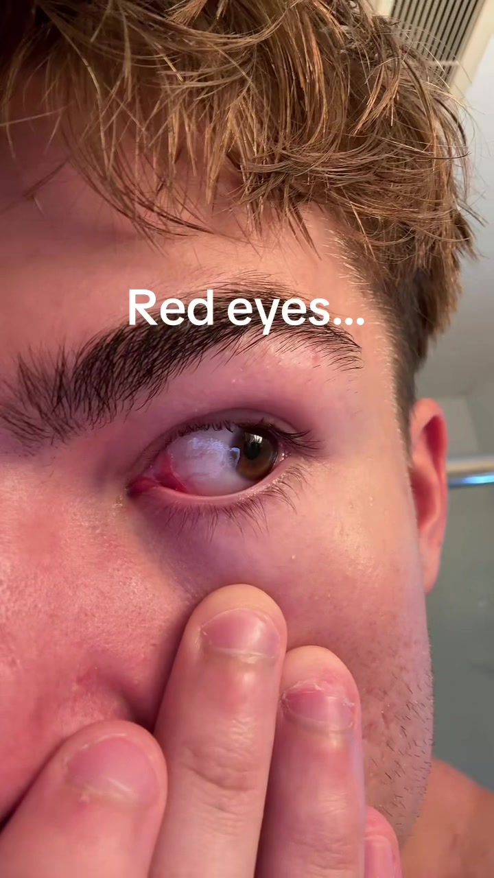 @Finn