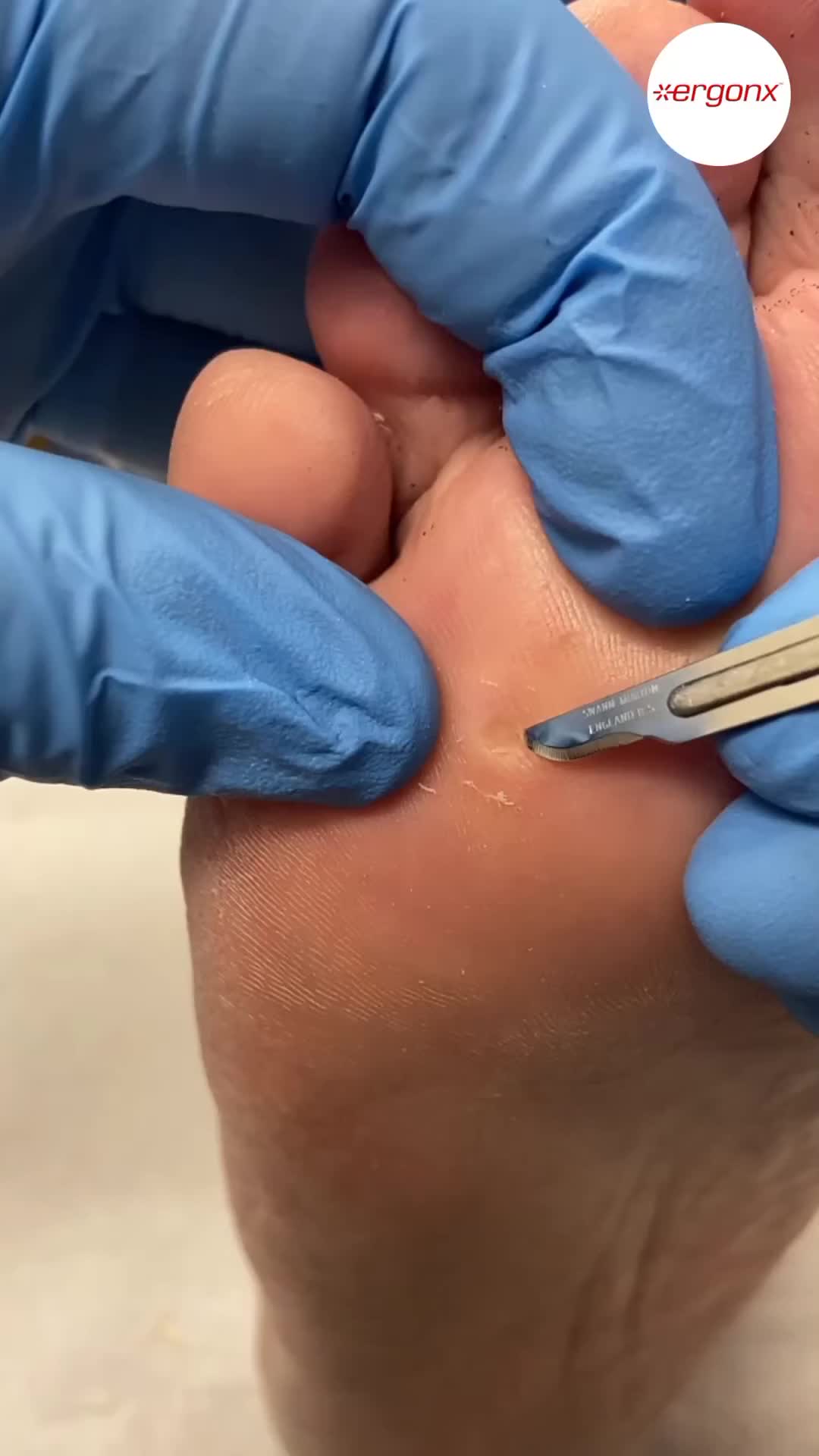@ergonx