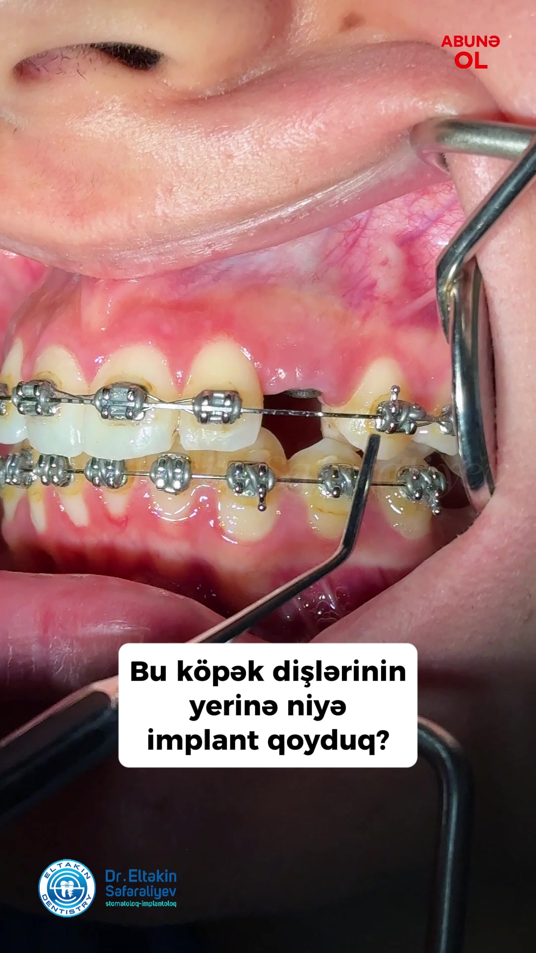 @eltakindentistry