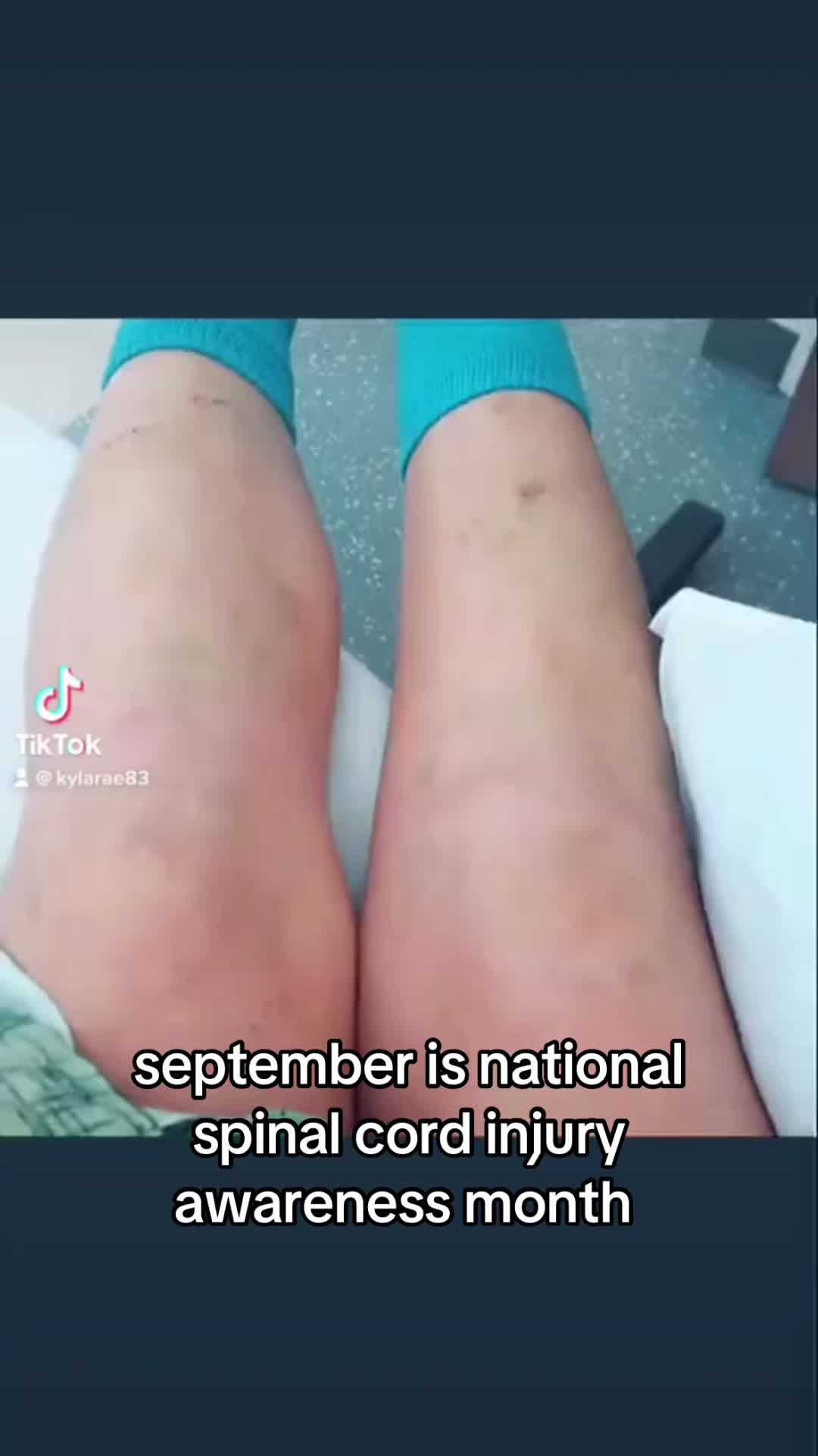 @k83 ๐๐๐