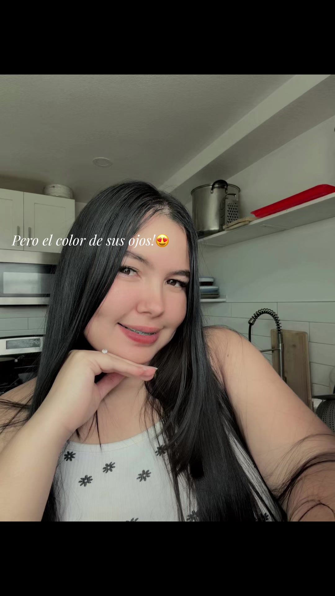 @𝙹 𝙰 𝚉 𝙼 𝙸 𝚁 𝙰 🍒