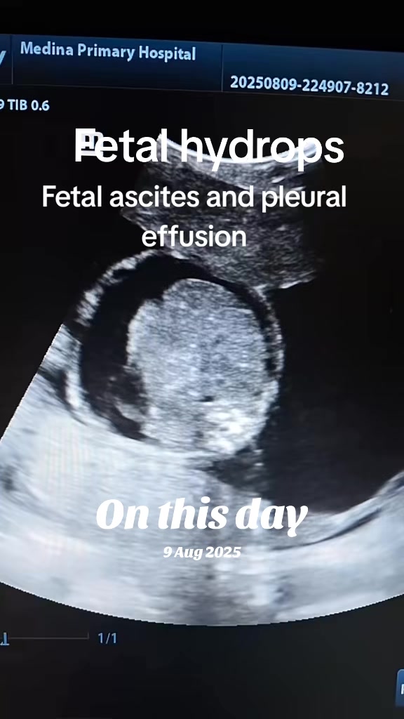 @Dr Wubie Endalew(Radiologist)