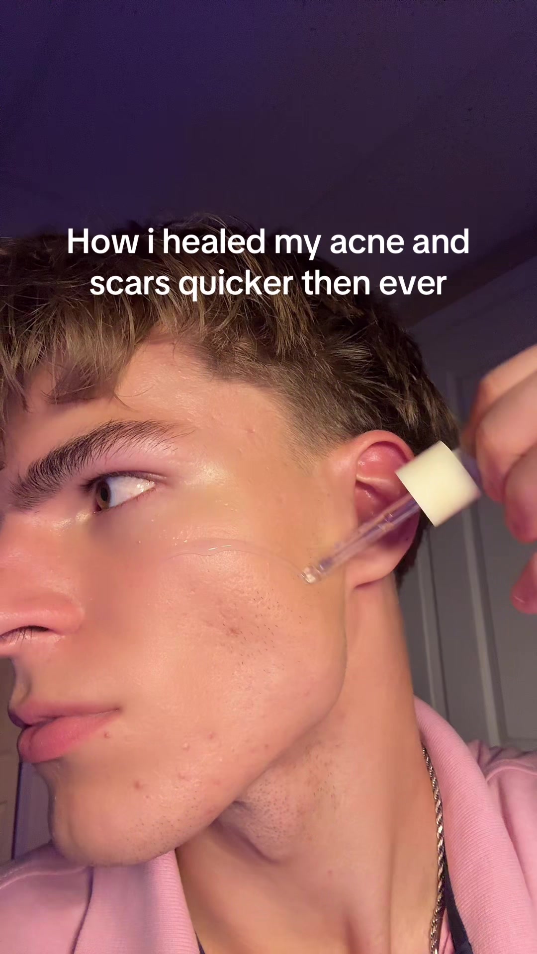 @Finn