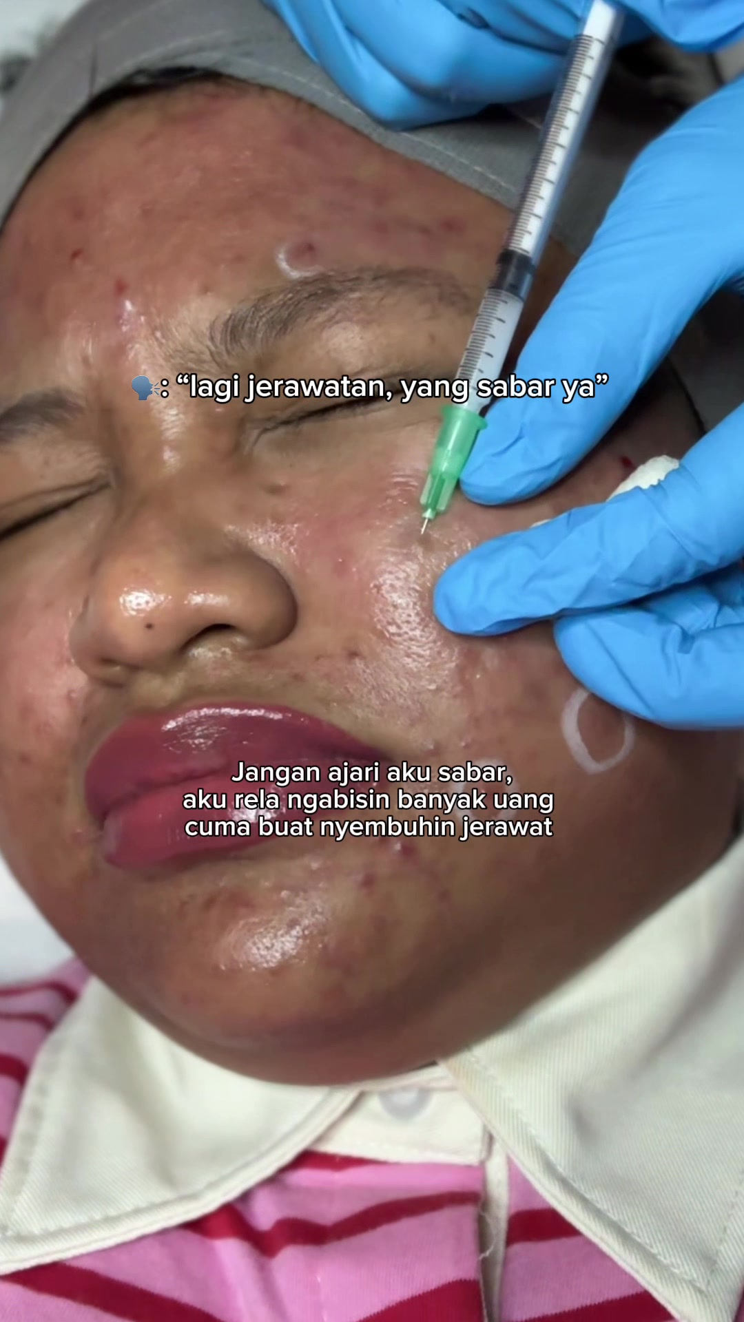 @MBAK CUNGCAT BAYI