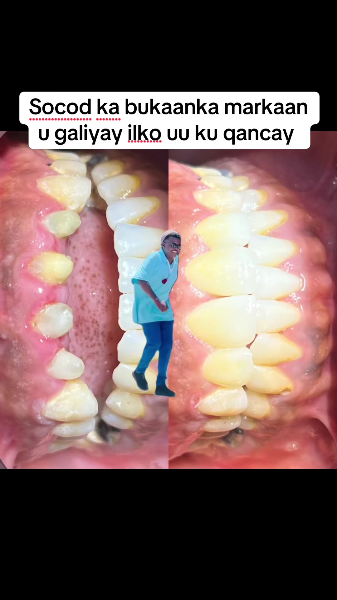 @Dr Abdirahman hassan laari