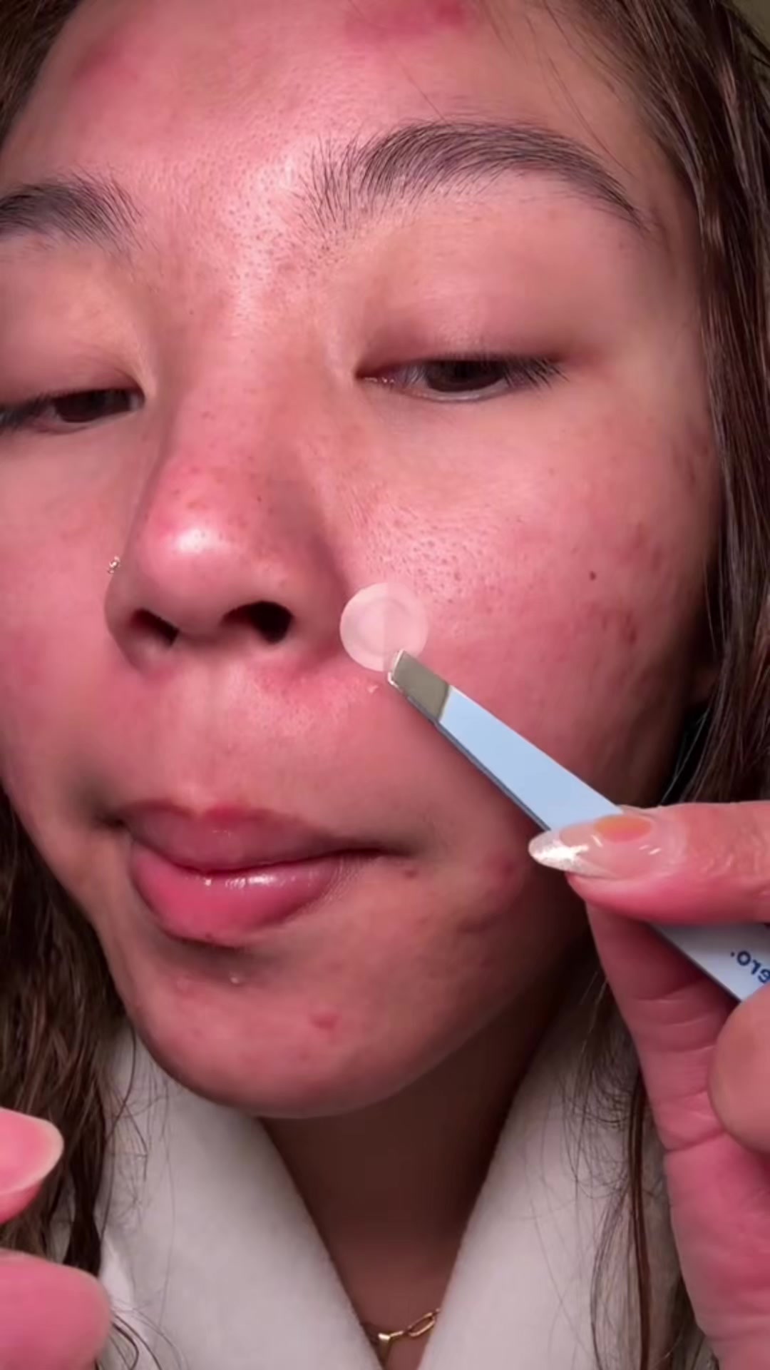 @Dermat&oacute;loga Cindy Burbano