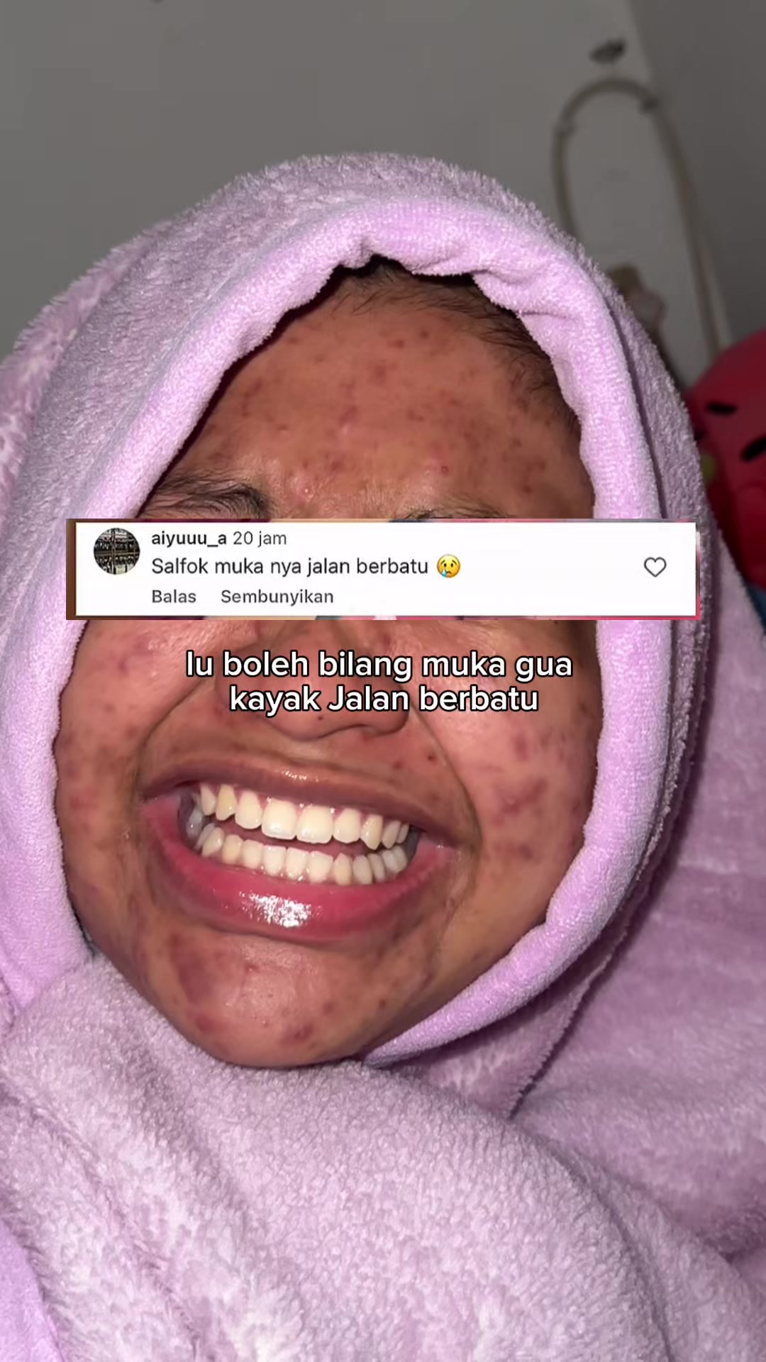 @MBAK CUNGCAT BAYI