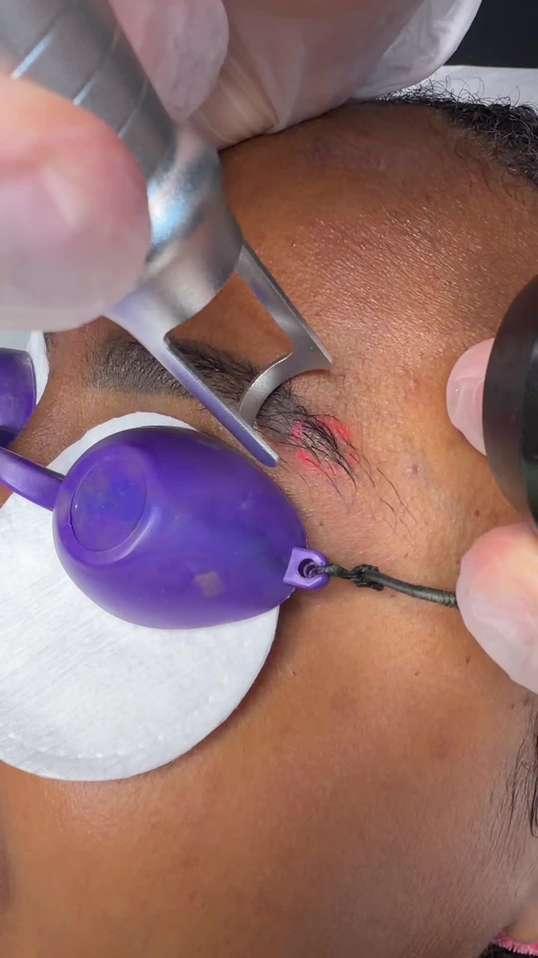 @Safe Eyebrows Tattoo Removal🗽