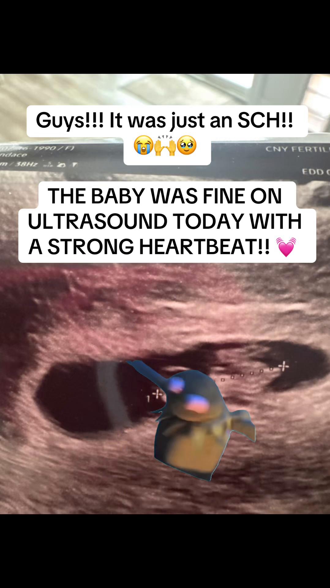 @Candi Rae | IVF Journey 💉🌸