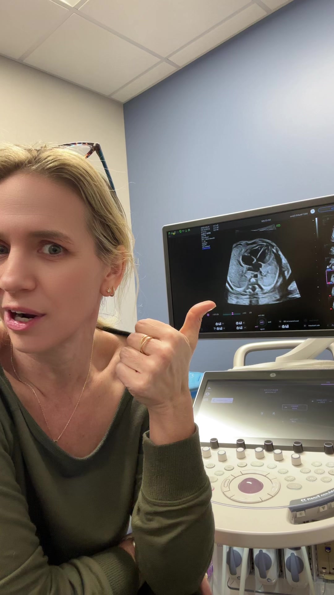 @Sonoeyes Ultrasound