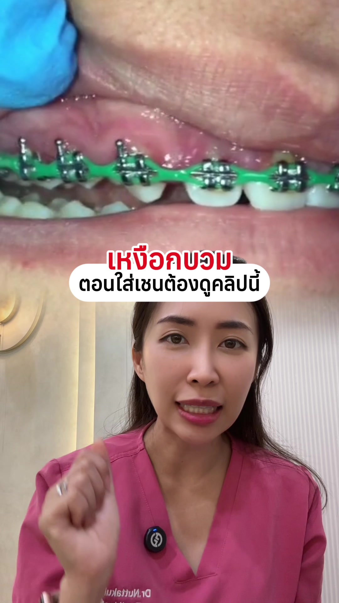@ณัฐคุณ (Nuttakul Dent) 🦷