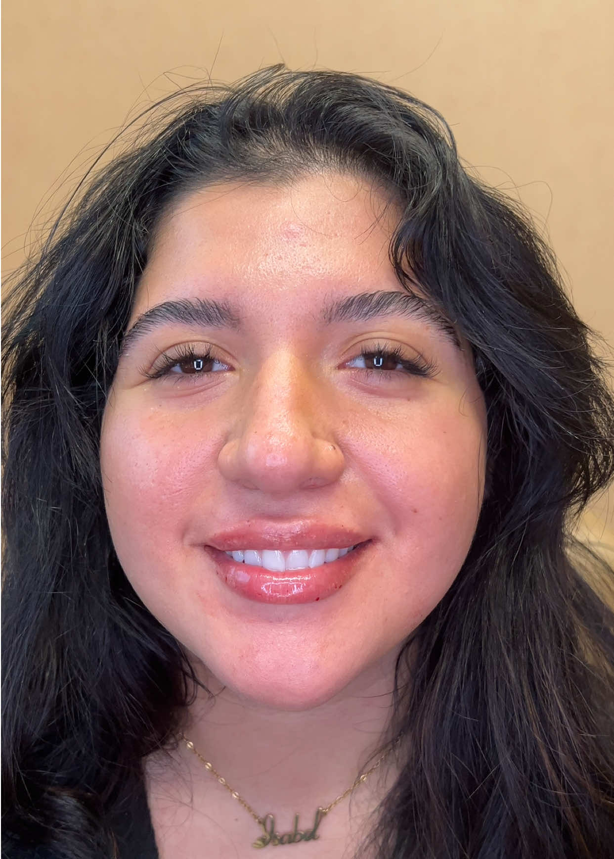 @Vanessa Injects