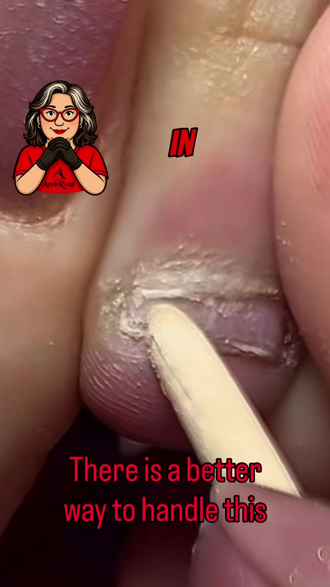 @AmberArchRivalry