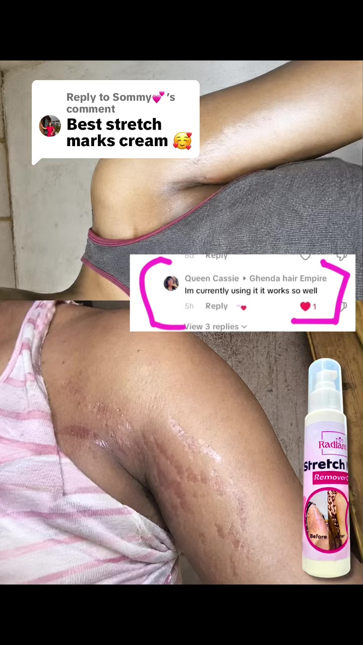 @Radiant skin