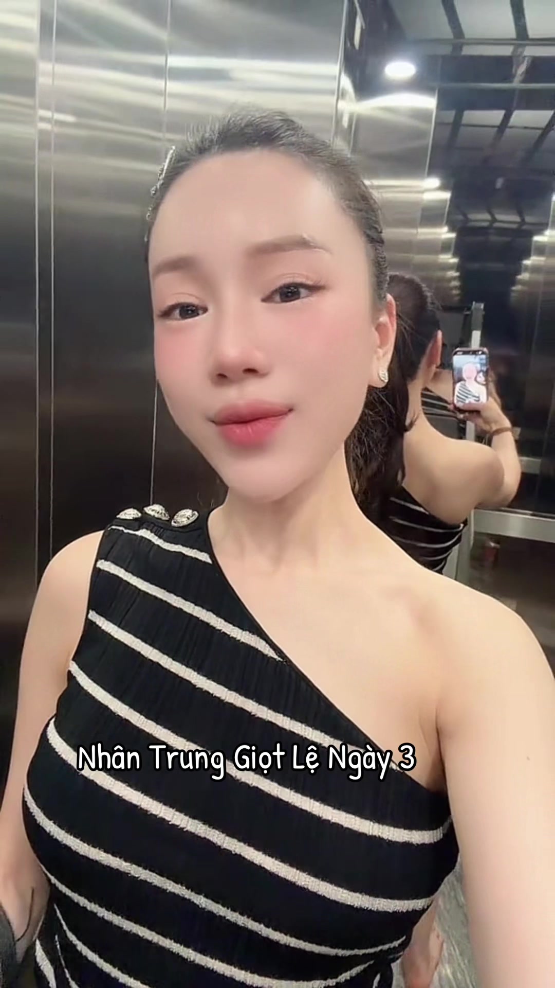 @Nhung MIRYO (L&agrave;m đẹp-Giảm b&eacute;o)