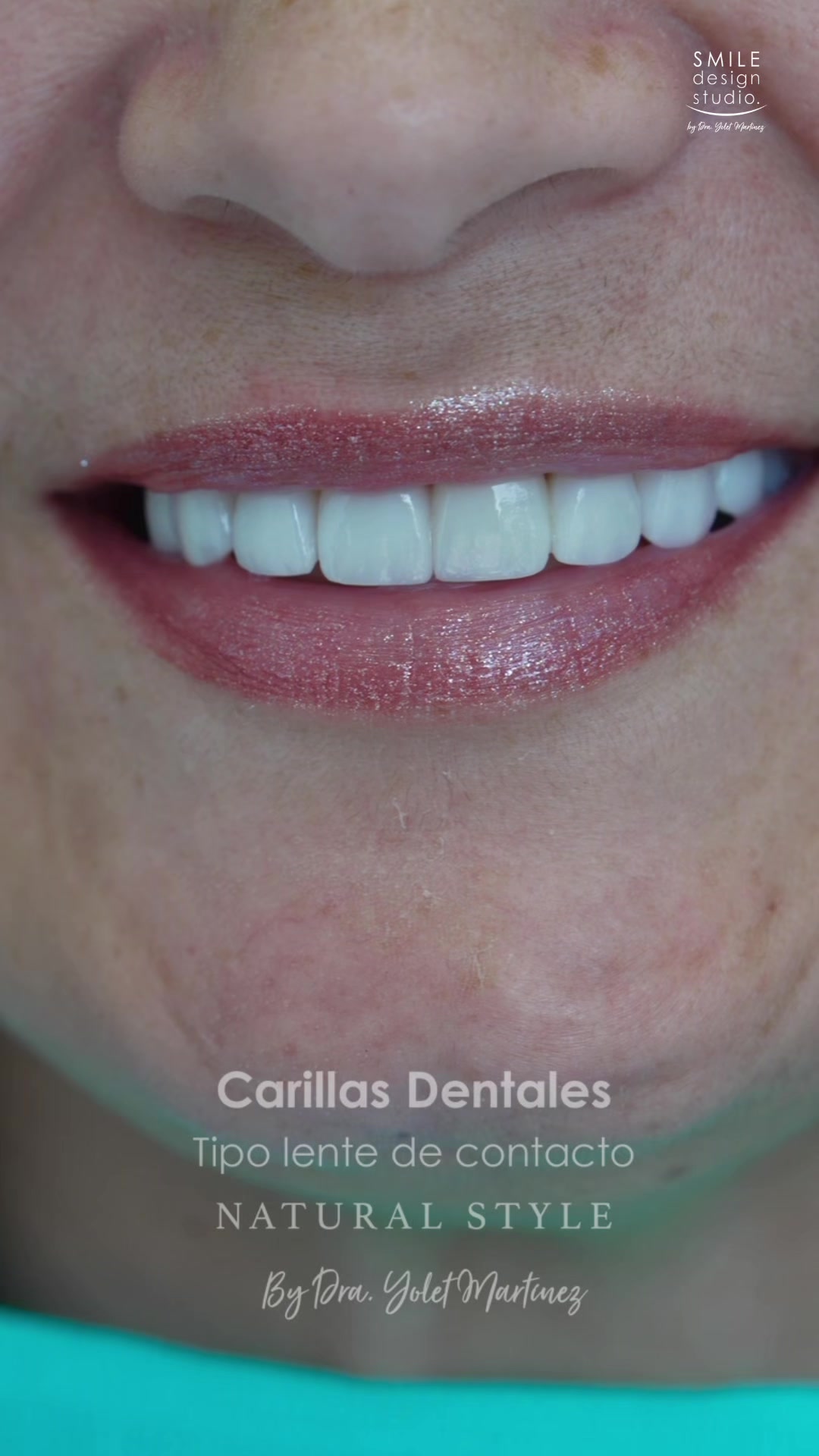 @SmileDesignStudio