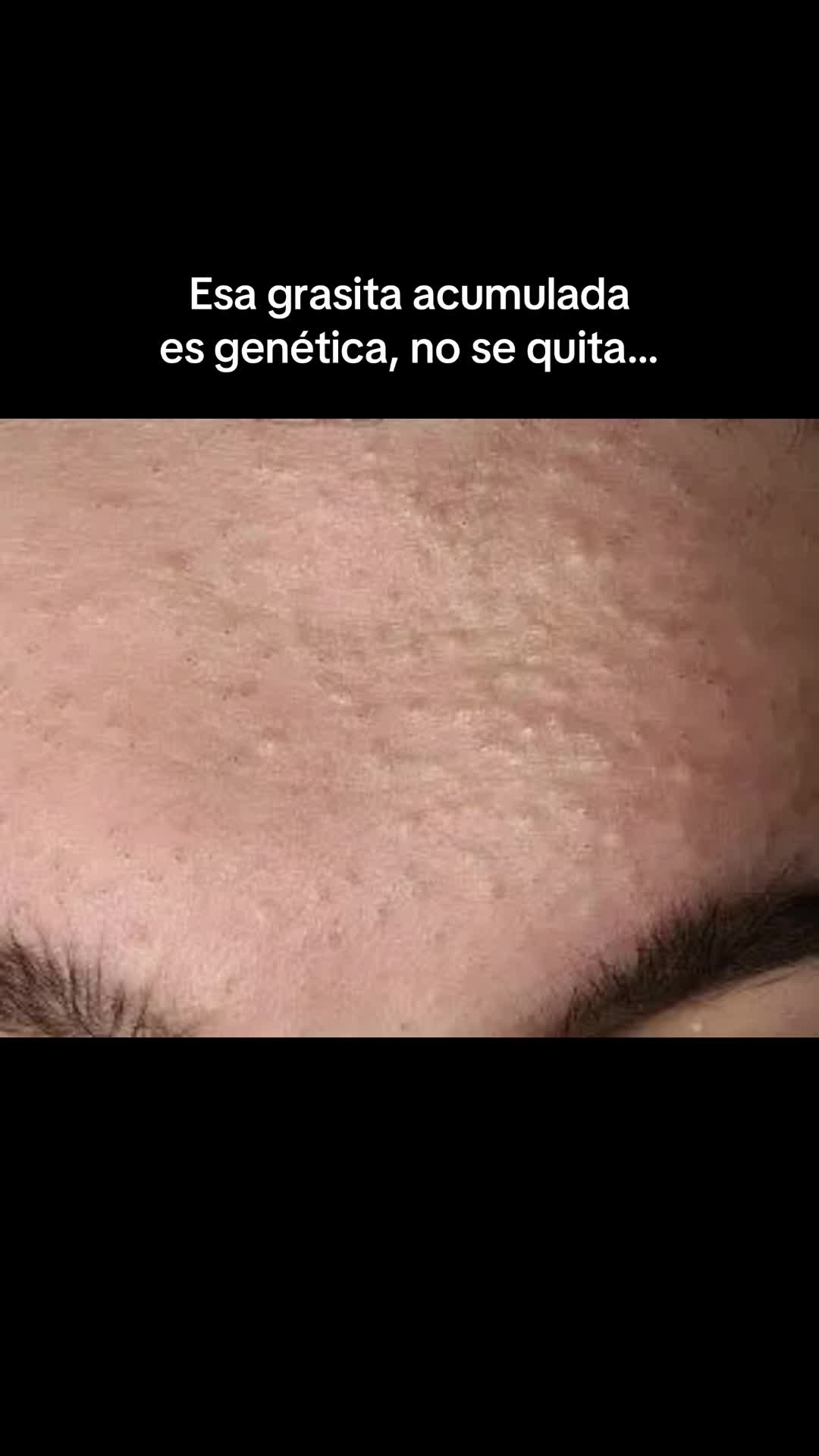 @Andy