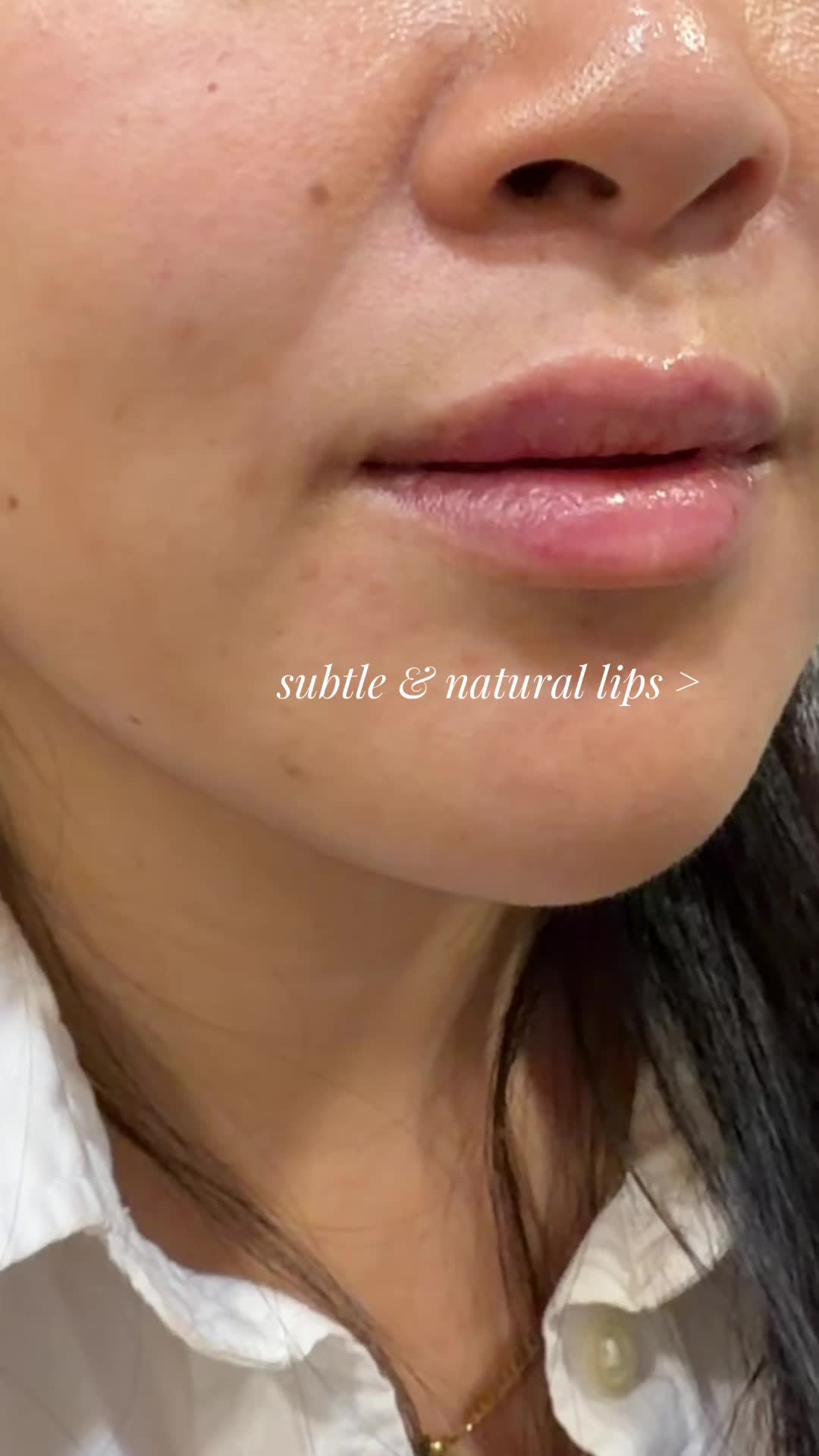 @DANIELLA PA-C