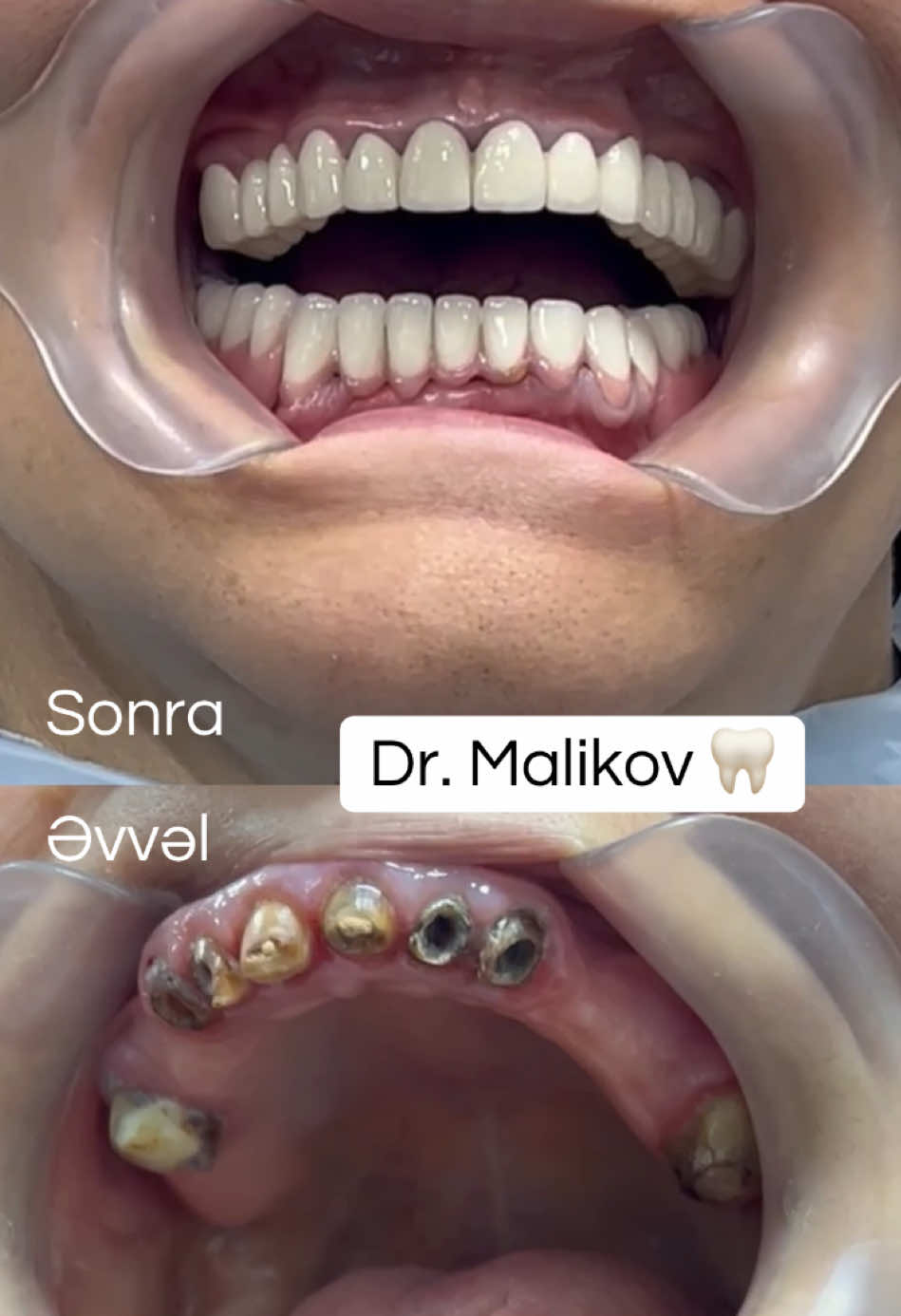 @Dr.Məhəmməd Məlikov