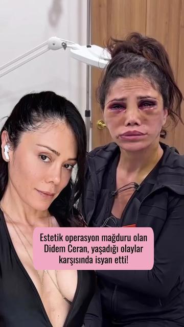 @Mynet Kadin