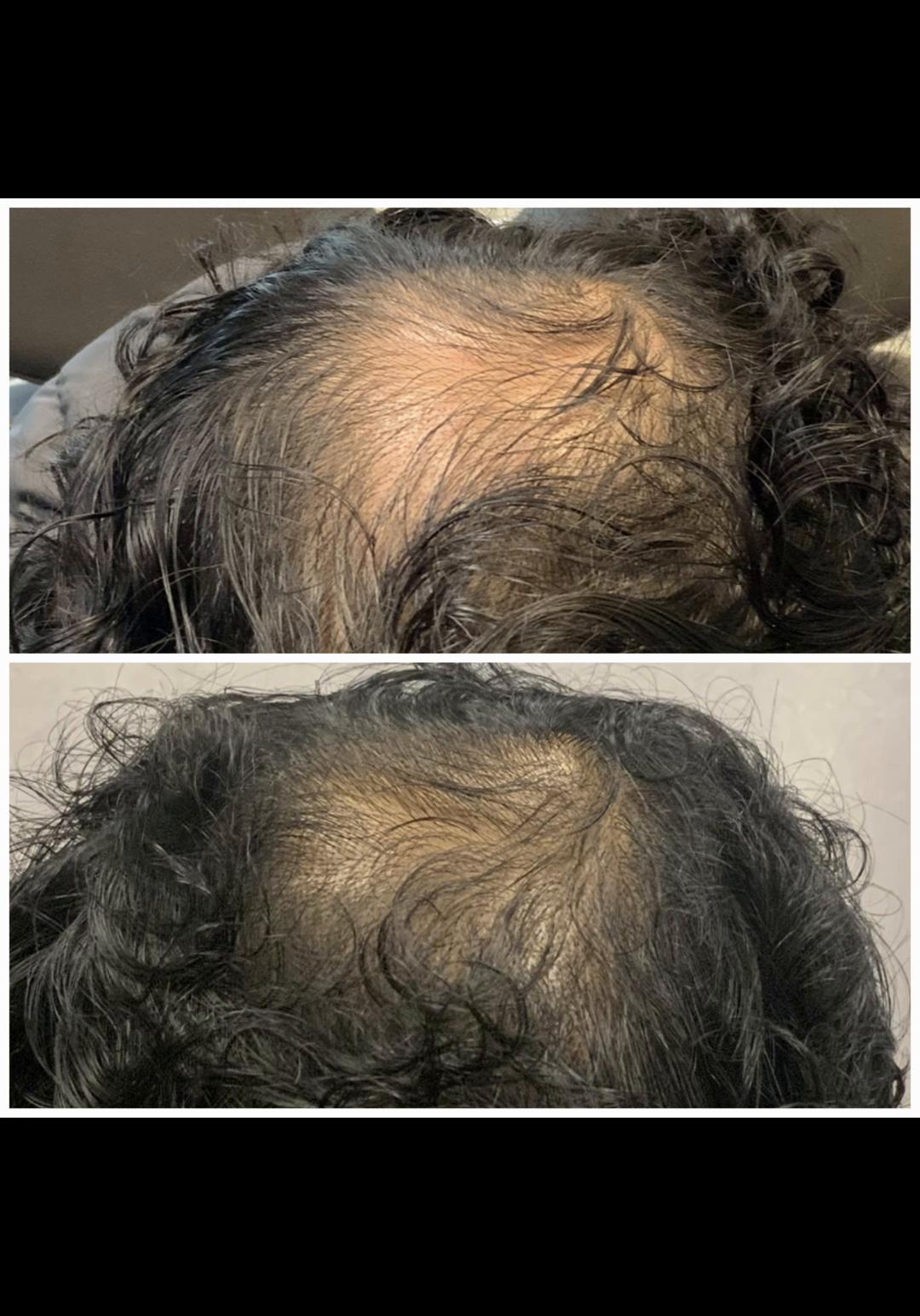 @Rosedermnyc