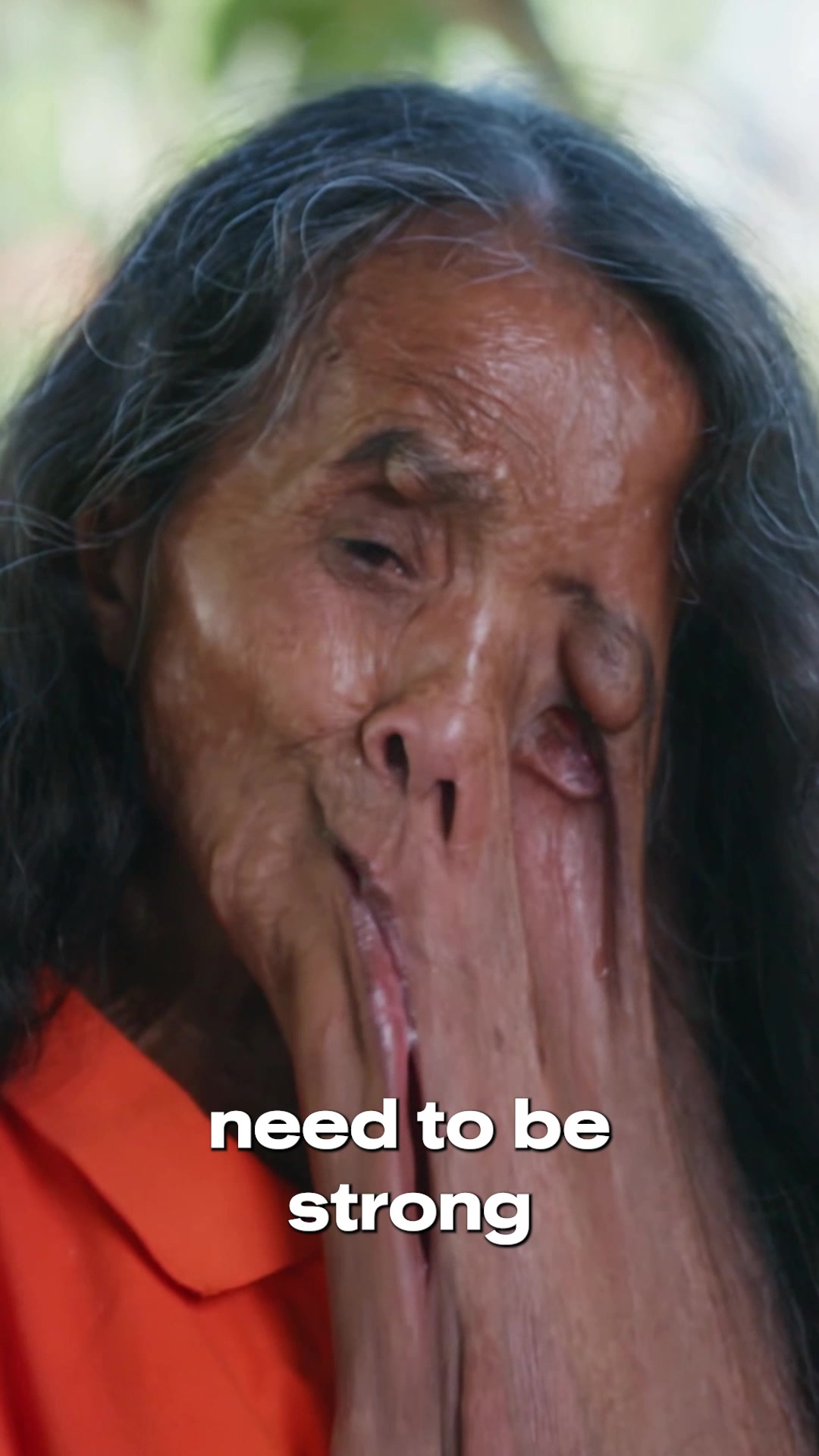 @tlc