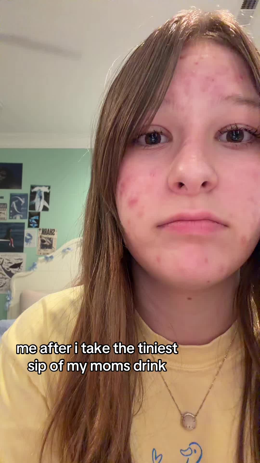 @rea