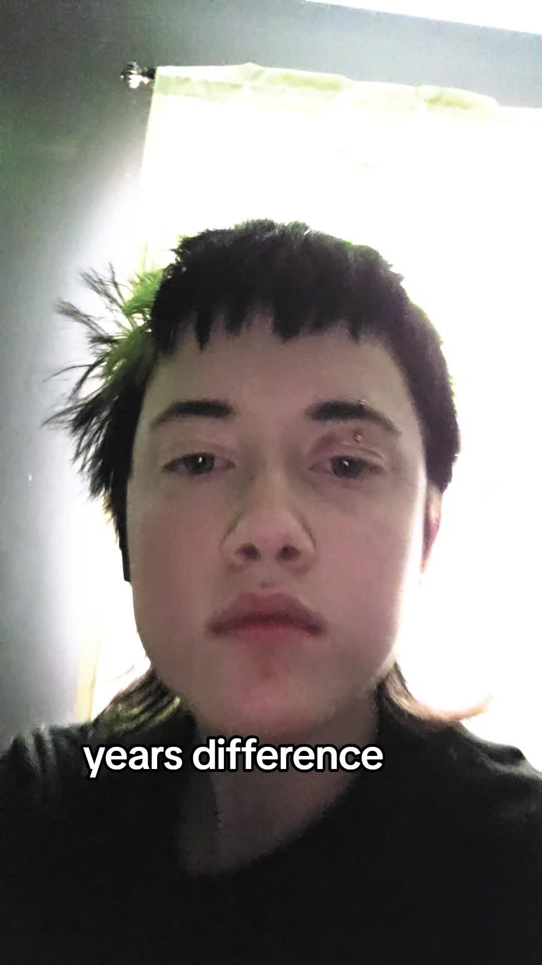 @skunk-head