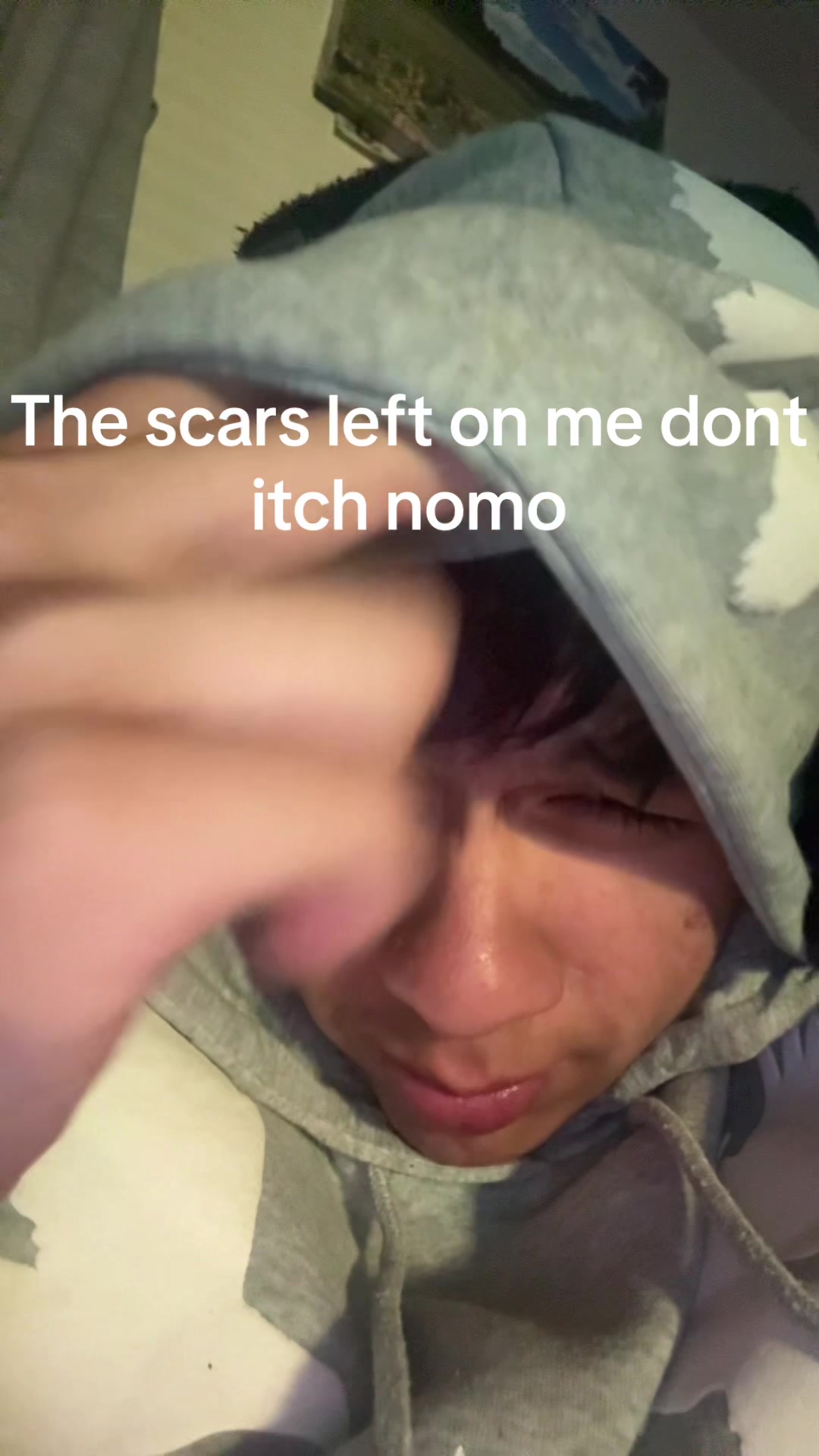 @X