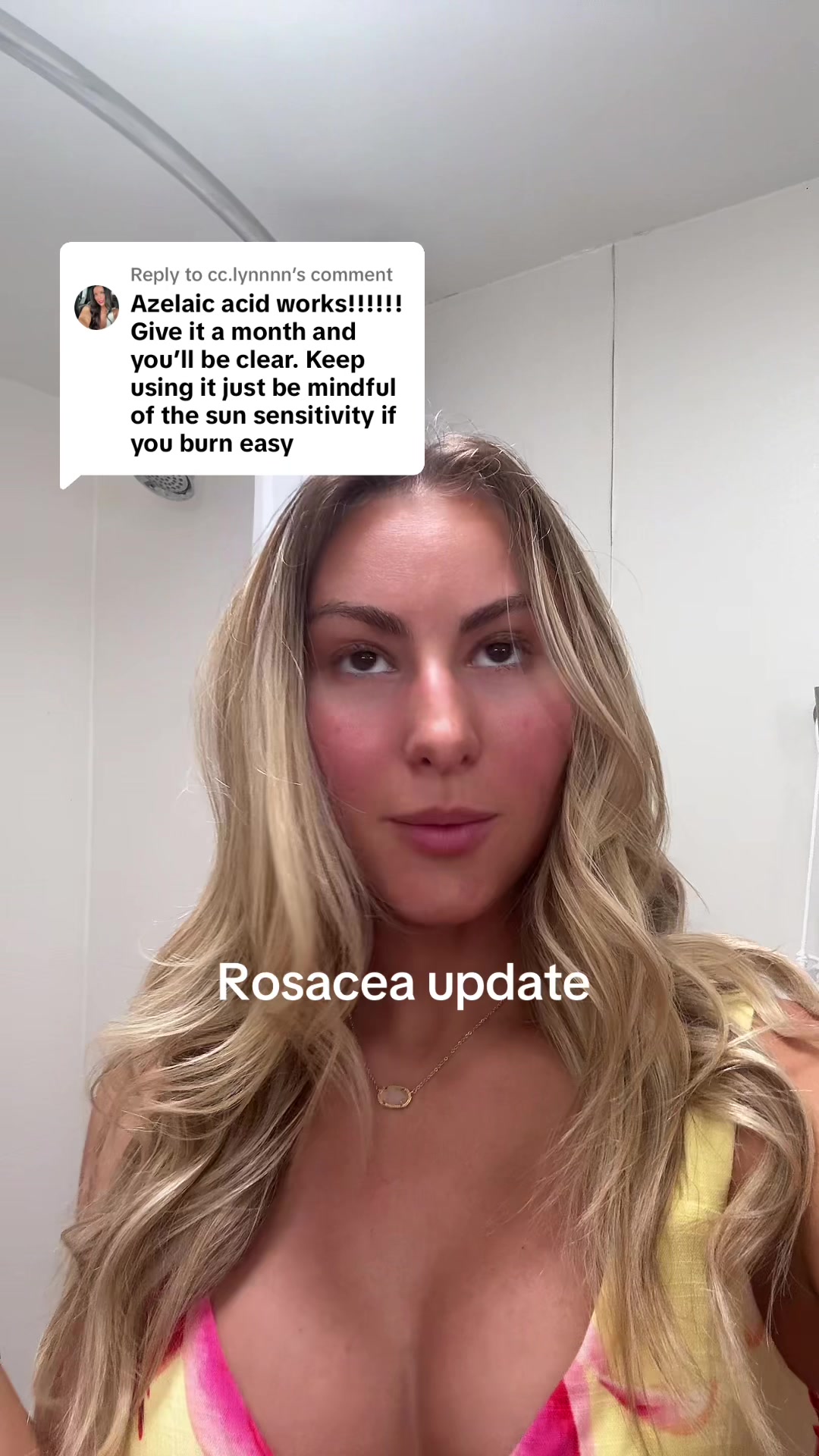 @Noelle Anzivine