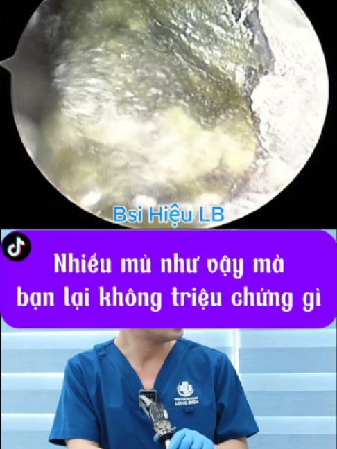 @Bs Hiệu Tai Mũi Họng Long Biên