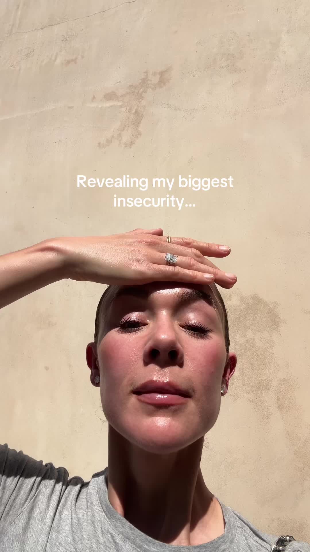 @Celeste | RN acne expert