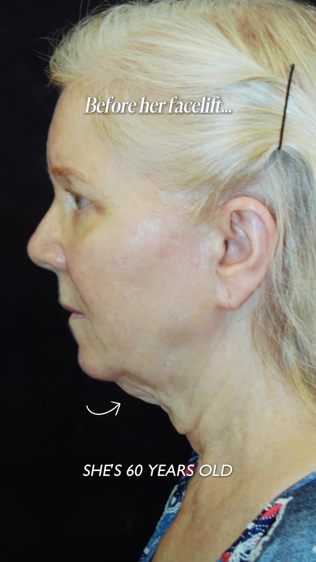 @Dr. Maia | Plastic Surgeon