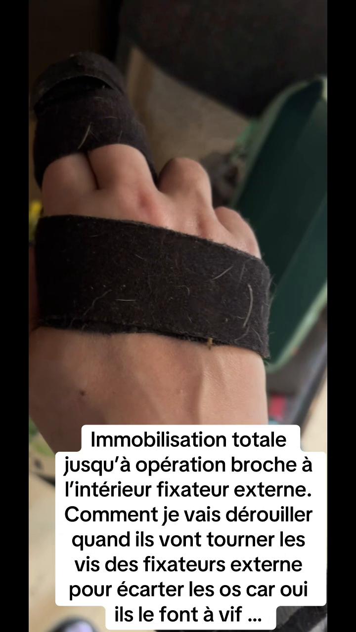 @Fallone~atypique