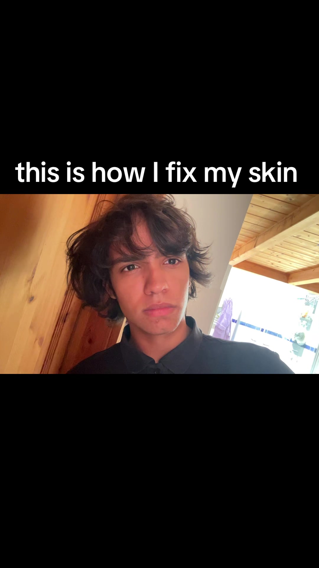 @YearnForBones