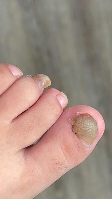 @Deniel Foot and Ankle Center