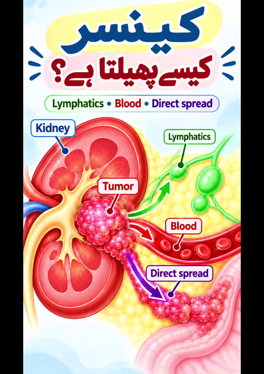 @Uro oncologist Dr Shaukat