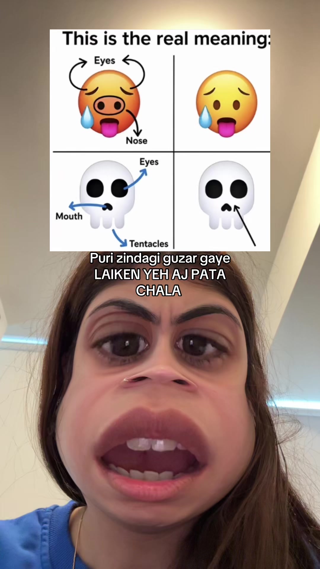 @Zoya Zaidi