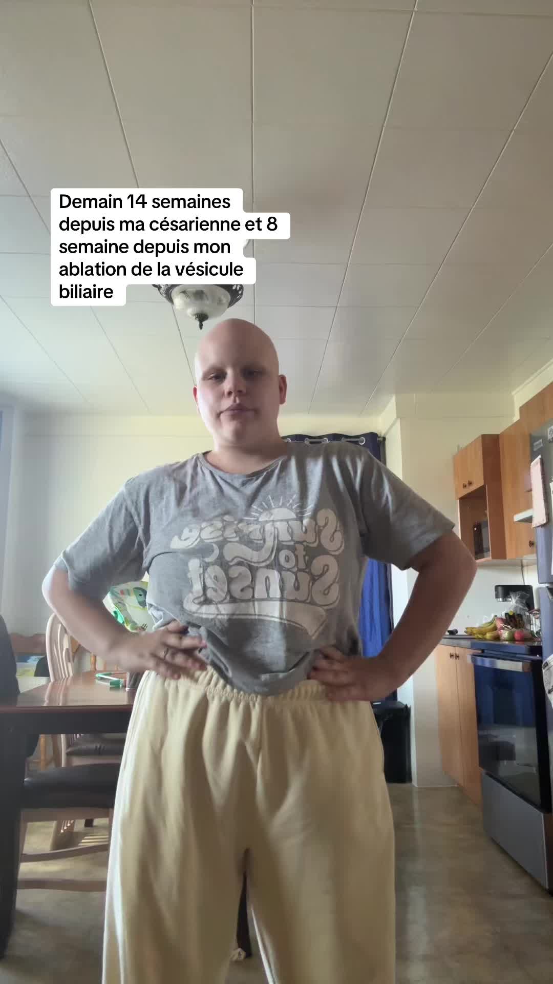@Alyson Michaud-Hall&eacute;