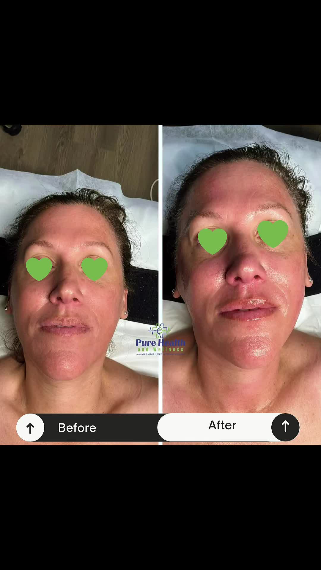 @PureHealthand_Wellness