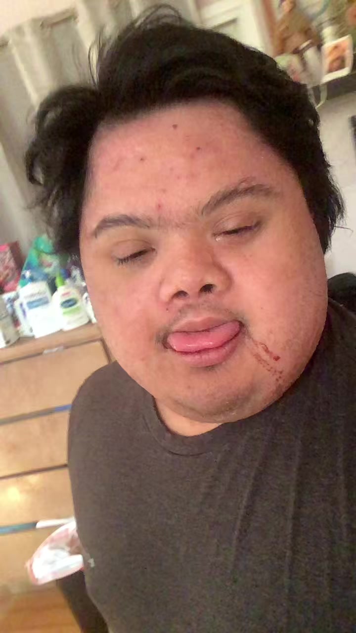 @2HYPE