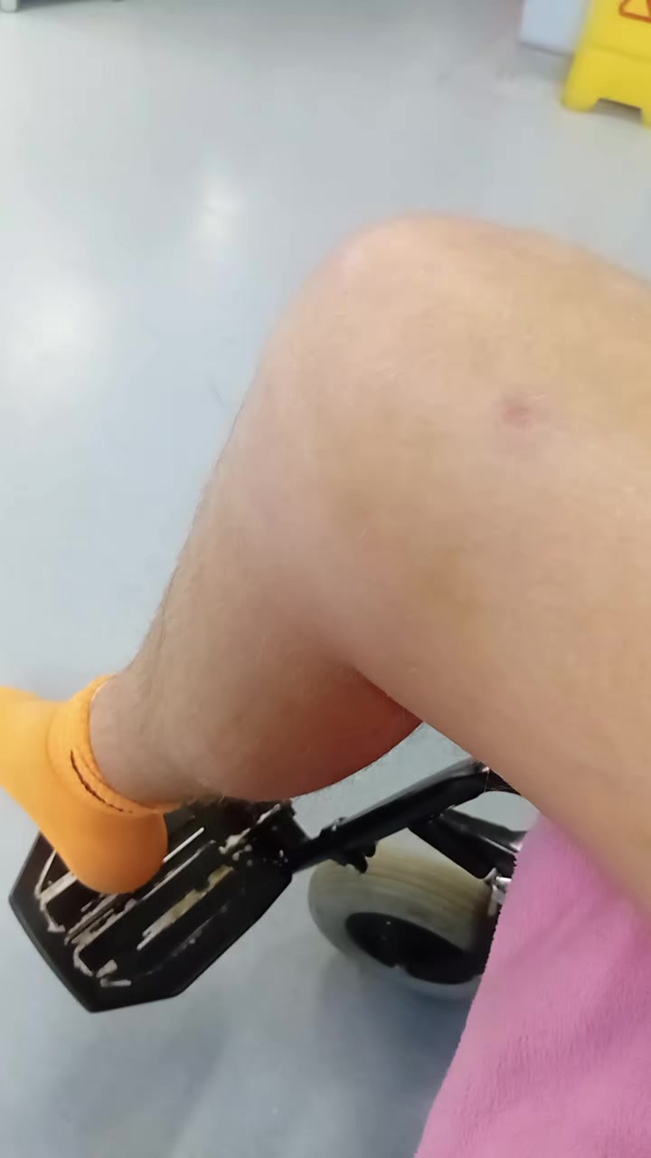 @D
