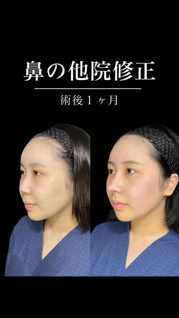 @ソ院長(バウム美容外科/トータル整形)