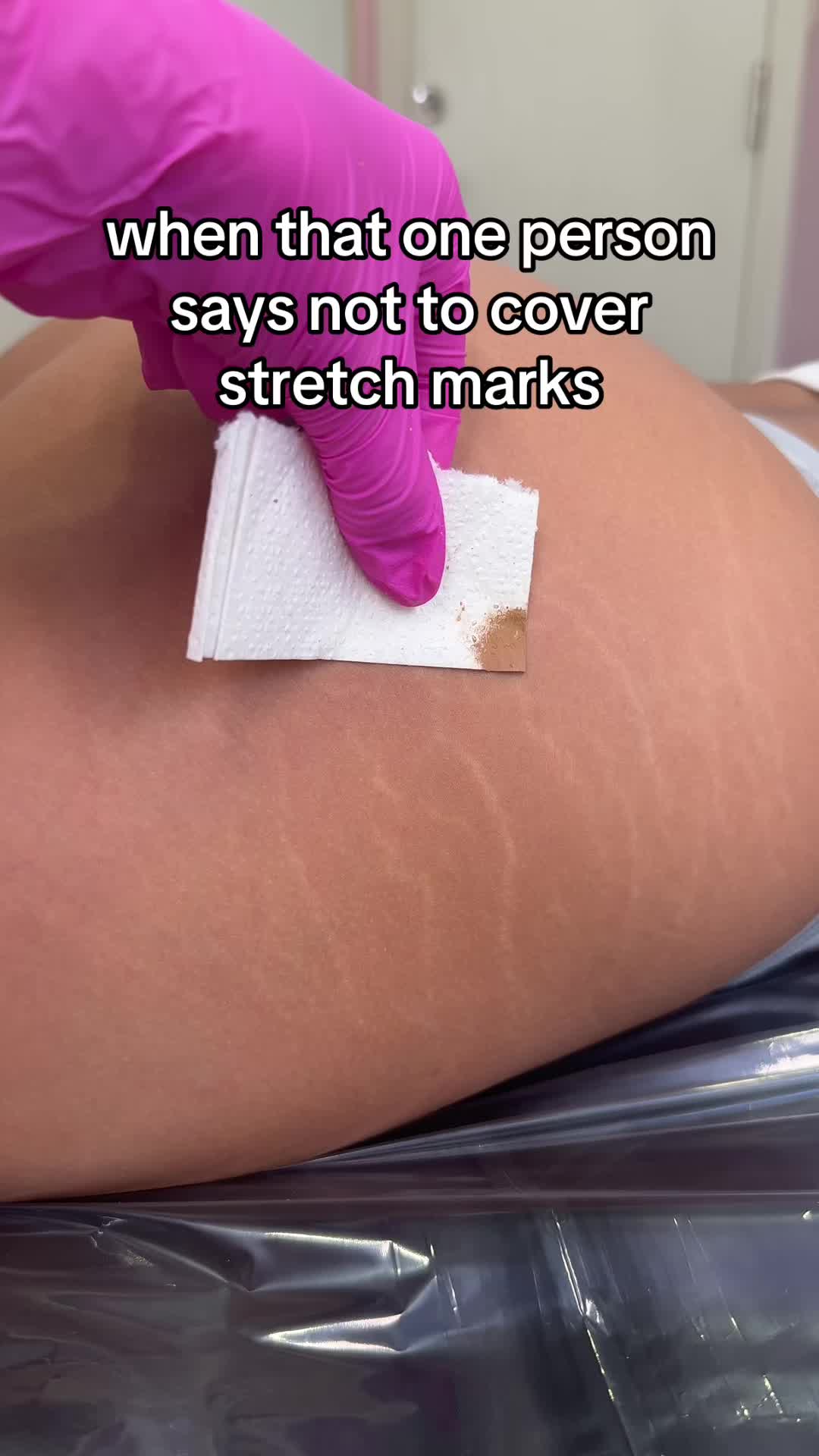 @Stretch Mark Fairy 🧚✨