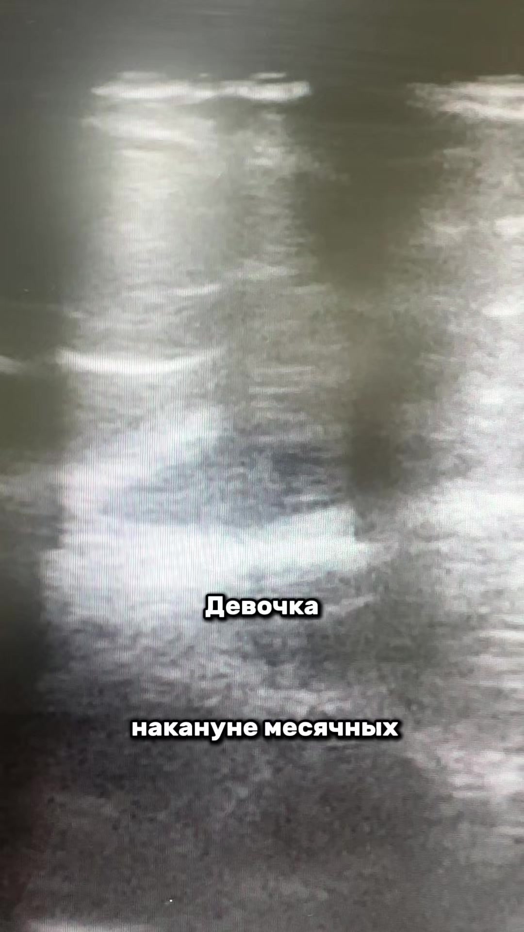 @Гинеколог Москва