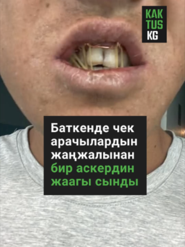 @Kaktus KG