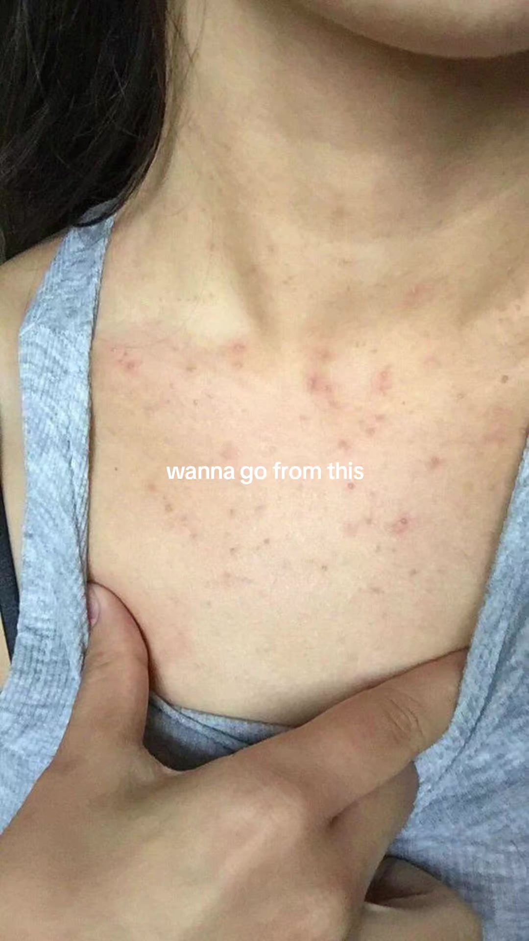 @arecelle