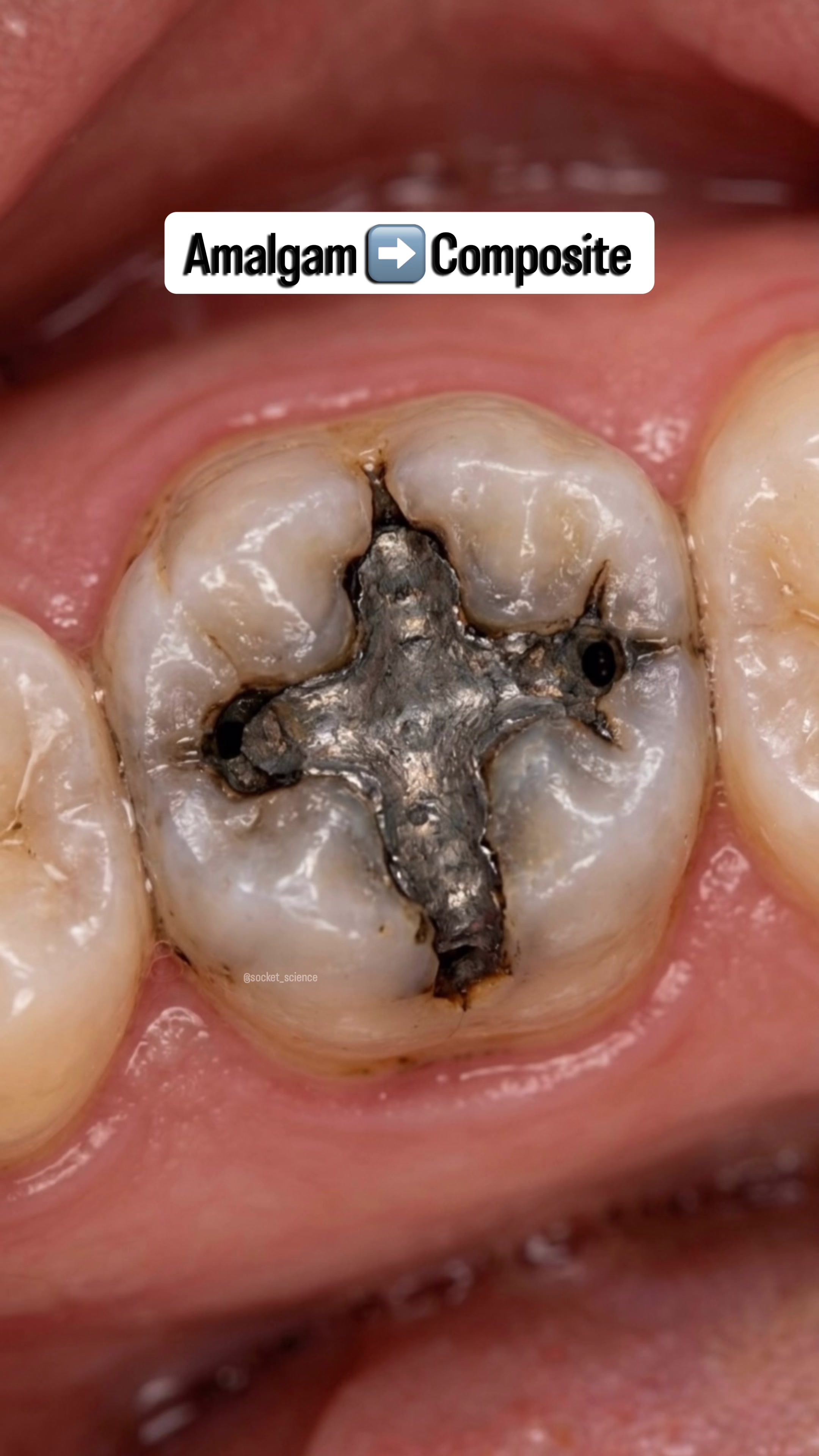 @Socket Science | Dental Visual