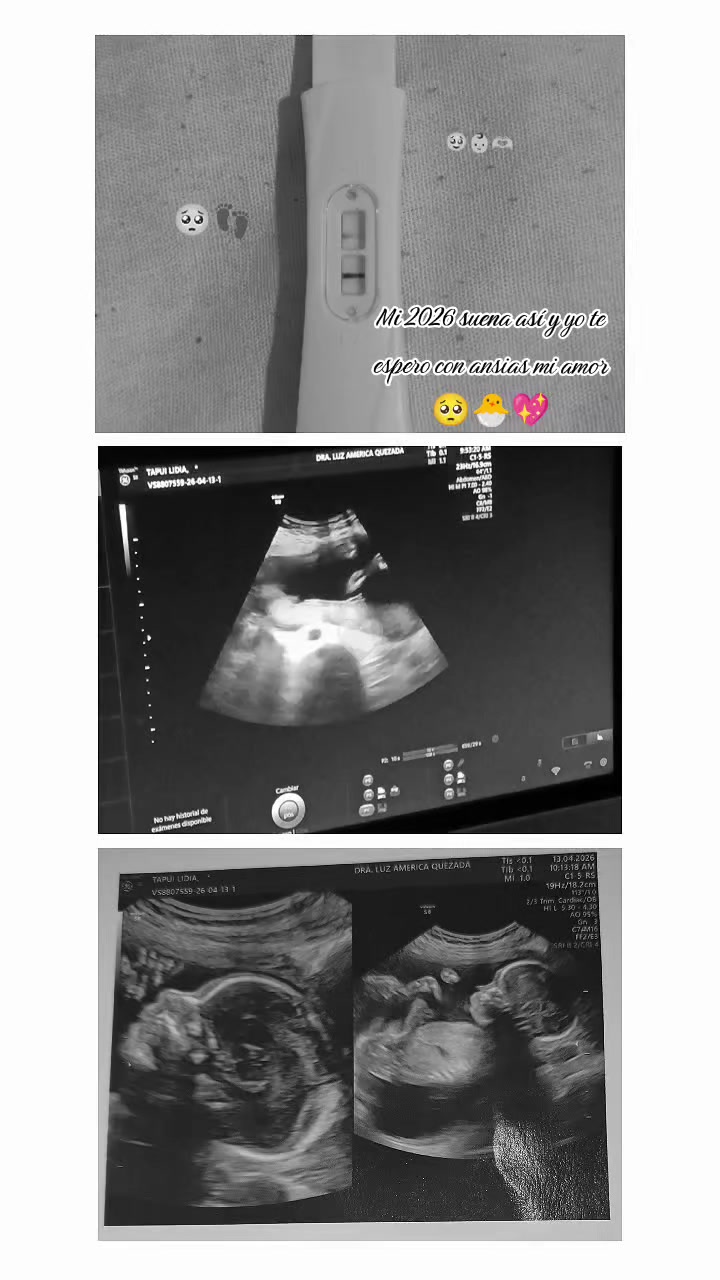 @🥀✿Y&uuml;l&icirc;ss&ordf;♡✿🍀🥺