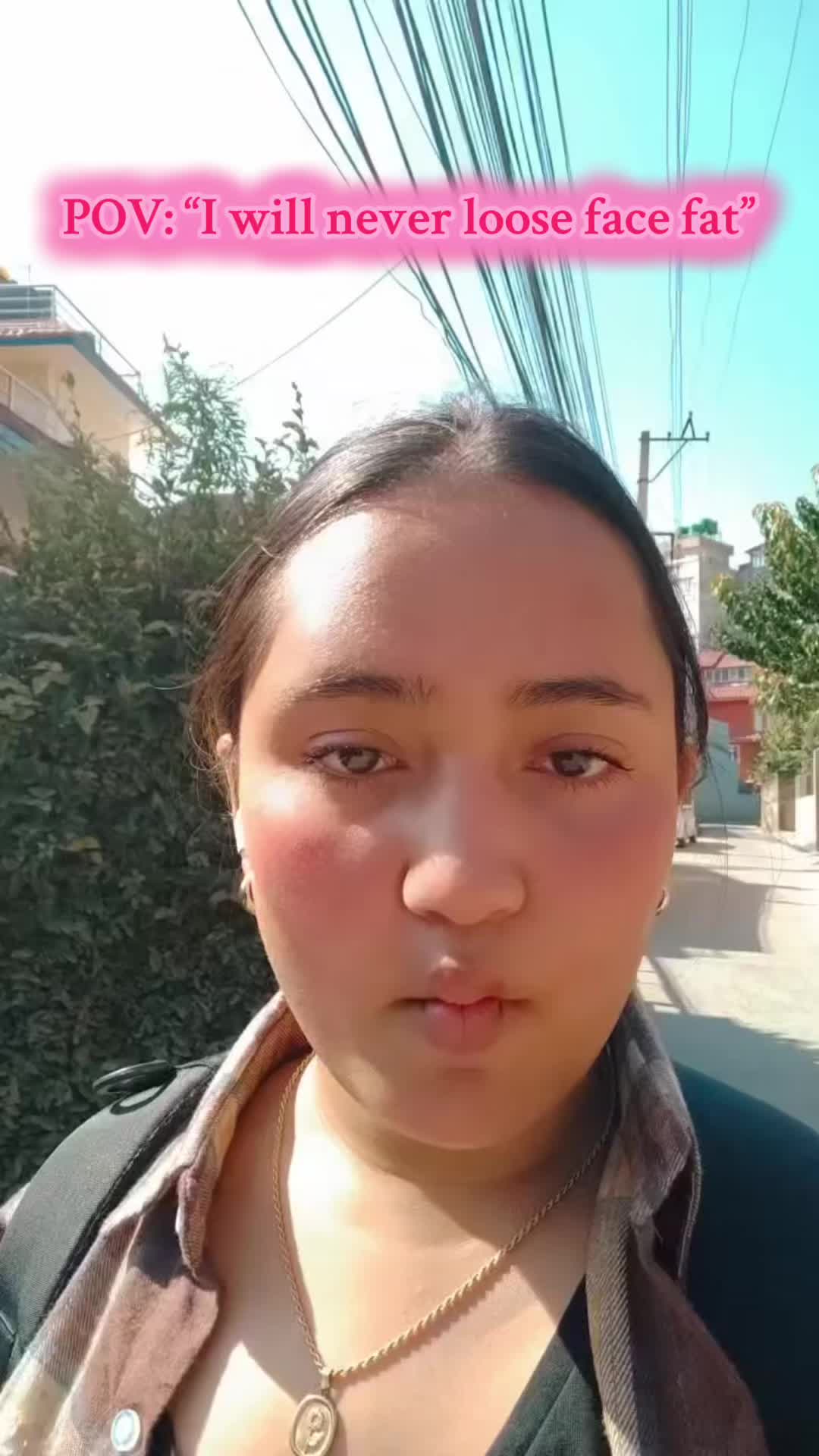 @Esther Siwa